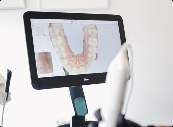 Digital dental scanner displaying a 3D jaw model