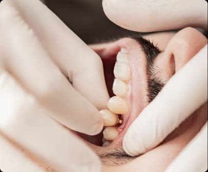Dental implant treatment planning